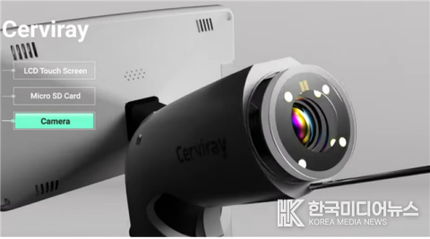 =사진설명 ; 자궁경부암 검진 AI 솔루션 ‘Cerviray AI’(제공=아이도트)