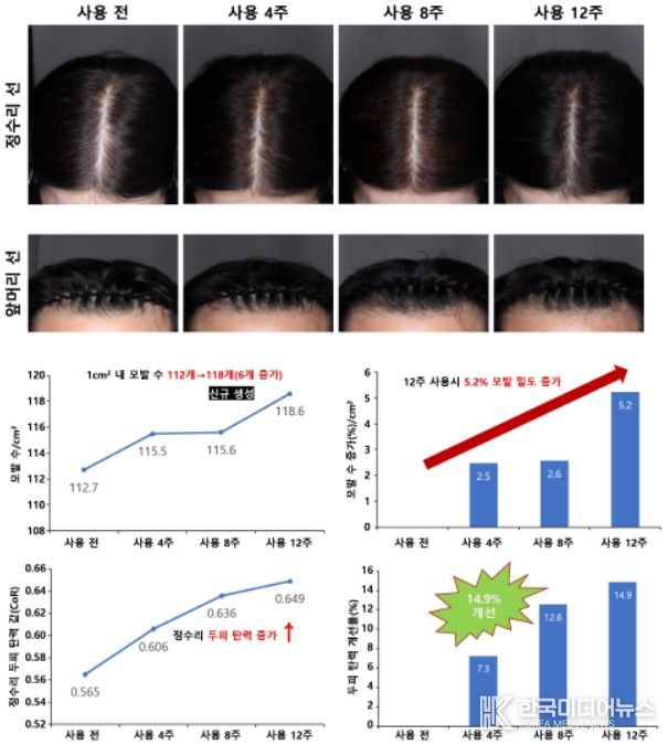 모발 밀도와 두피 탄력 개선